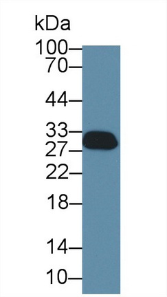 Stratifin (SFN) Human Polyclonal Antibody
