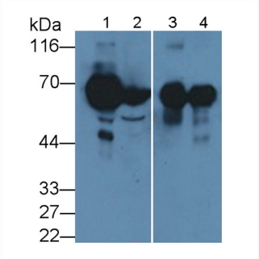 Suprabasin (SBSN) Human Polyclonal Antibody