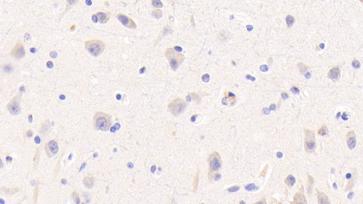 Riboflavin Kinase (RFK) Human Polyclonal Antibody