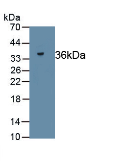 Reticulocalbin 2 (RCN2) Human Polyclonal Antibody