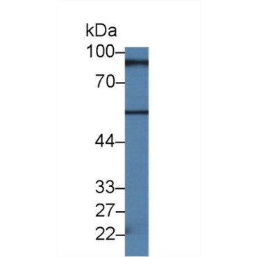 RalA Binding Protein 1 (RALBP1) Human Polyclonal Antibody