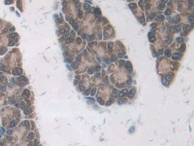 Renal Tumor Antigen (RAGE) Rat Polyclonal Antibody