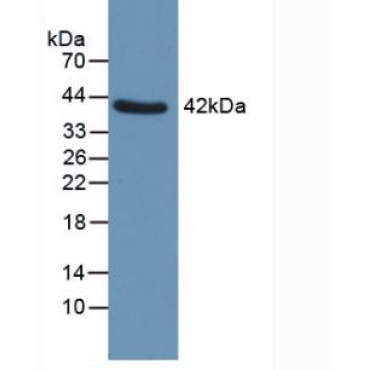 Glutaminyl Peptide Cyclotransferase (QPCT) Human Polyclonal Antibody