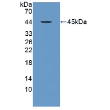 Protamine 2 (PRM2) Human Polyclonal Antibody