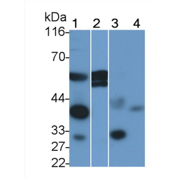 Prolactin Receptor (PRLR) Human Polyclonal Antibody