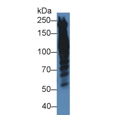 Periplakin (PPL) Human Polyclonal Antibody