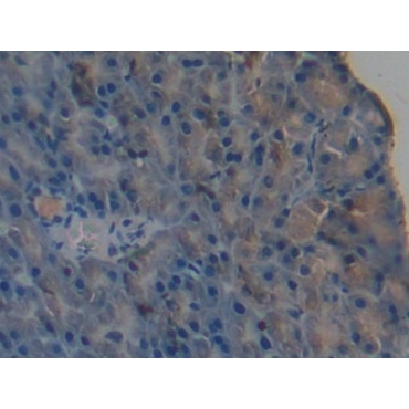 Periplakin (PPL) Mouse Polyclonal Antibody