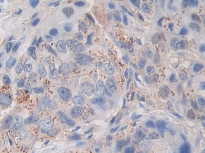 Periostin (POSTN) Human Polyclonal Antibody