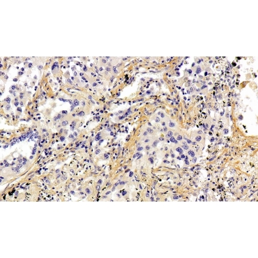 Periostin (POSTN) Human Polyclonal Antibody