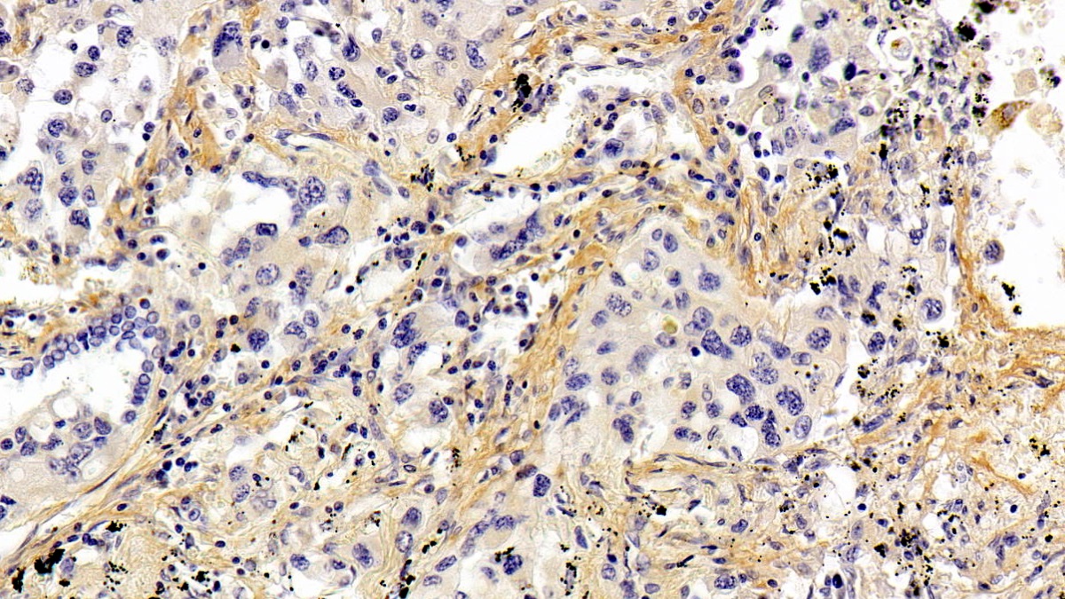 Periostin (POSTN) Human Polyclonal Antibody