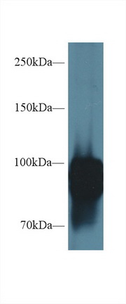 Periostin (POSTN) Rat Polyclonal Antibody