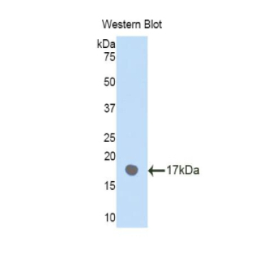 Plexin B1 (PLXNB1) Human Polyclonal Antibody