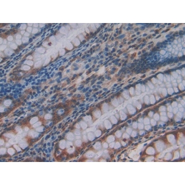 Plexin B1 (PLXNB1) Human Polyclonal Antibody