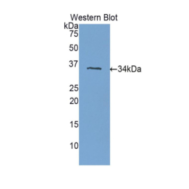Plexin B1 (PLXNB1) Human Polyclonal Antibody