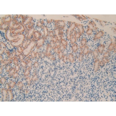 Plexin B1 (PLXNB1) Mouse Polyclonal Antibody