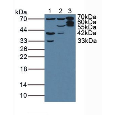Plastin 3 (PLS3) Human Polyclonal Antibody