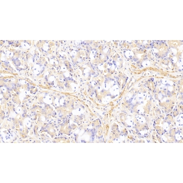 Plastin 3 (PLS3) Human Polyclonal Antibody