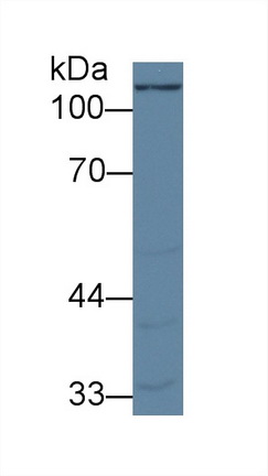 Pyruvate Carboxylase (PC) Human Polyclonal Antibody