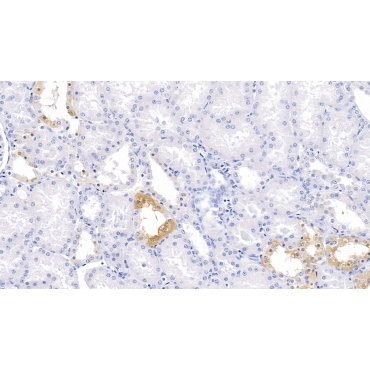 Polybromo 1 (PBRM1) Human Polyclonal Antibody
