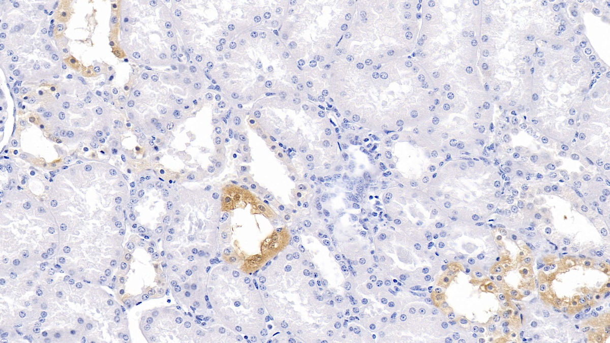 Polybromo 1 (PBRM1) Human Polyclonal Antibody
