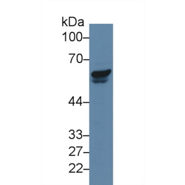 p21 Protein Activated Kinase 2 (PAK2) Human Polyclonal Antibody