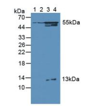 3-Oxoacid Coenzyme A Transferase 1 (OXCT1) Human Polyclonal Antibody