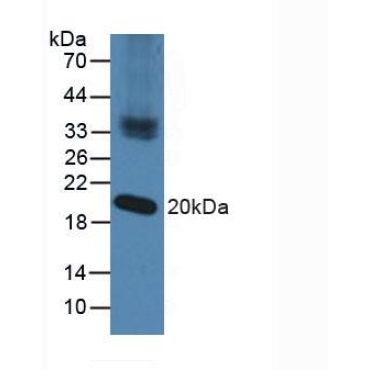 Nucleoredoxin (NXN) Human Polyclonal Antibody