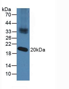 Nucleoredoxin (NXN) Human Polyclonal Antibody