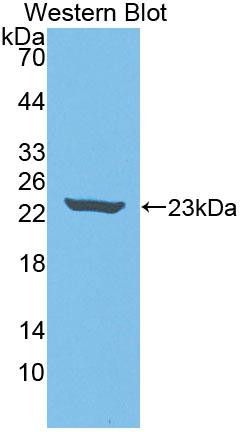 Neuropathy Target Esterase (NTE) Rat Polyclonal Antibody