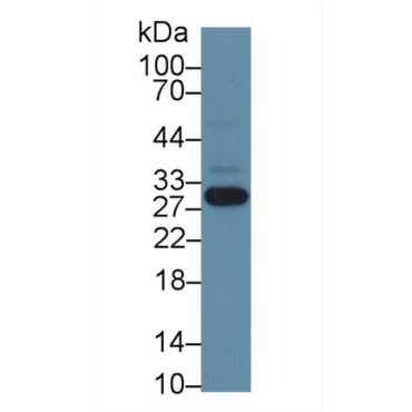 Nicotinamide-N-Methyltransferase (NNMT) Human Polyclonal Antibody