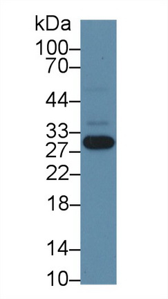 Nicotinamide-N-Methyltransferase (NNMT) Human Polyclonal Antibody