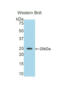 Nexilin (NEXN) Human Polyclonal Antibody