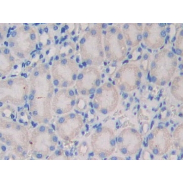 Nexilin (NEXN) Mouse Polyclonal Antibody