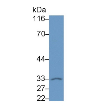 Neurogenic Differentiation 6 (NEUROD6) Human Polyclonal Antibody