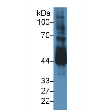 Never In Mitosis Gene A Related Kinase 2 (NEK2) Mouse Polyclonal Antibody