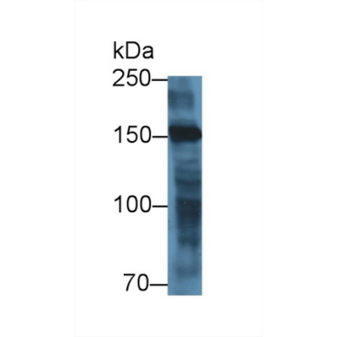 Myomesin 2 (MYOM2) Human Polyclonal Antibody