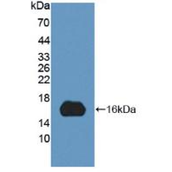 C-Myc Binding Protein (MYCBP) Human Polyclonal Antibody