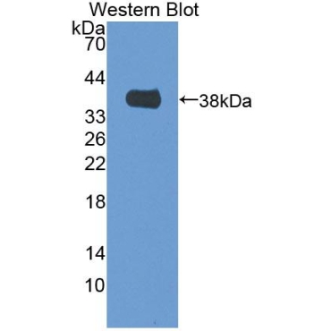 Mitochondrial Methionyl tRNA Formyltransferase (MTFMT) Mouse Polyclonal Antibody