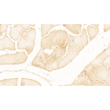 Mesothelin (MSLN) Human Polyclonal Antibody