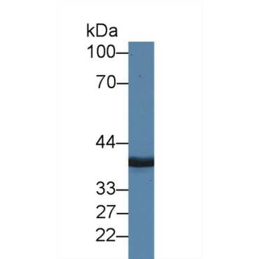 Mannose Phosphate Isomerase (MPI) Human Polyclonal Antibody