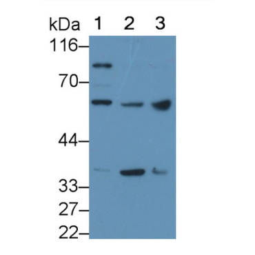 Microphthalmia Associated Transcription Factor (MITF) Human Polyclonal Antibody