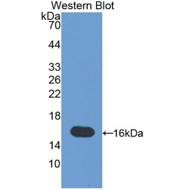Melanoma Inhibitory Activity Protein 1 (MIA1) Mouse Polyclonal Antibody