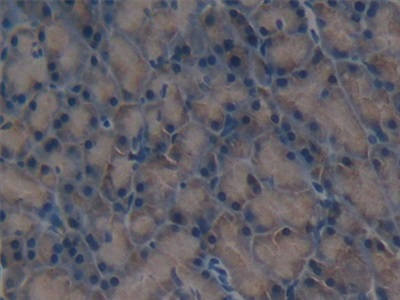 Melanoma Inhibitory Activity Protein 1 (MIA1) Rat Polyclonal Antibody