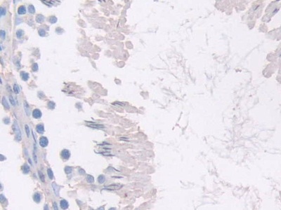 Meteorin (METRN) Rat Polyclonal Antibody