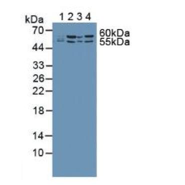 Malic Enzyme 2, NADP+ Dependent, Mitochondrial (ME2) Human Polyclonal Antibody