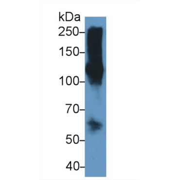 Malate Dehydrogenase 2 (MDH2) Human Polyclonal Antibody