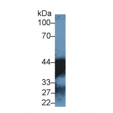 Malate Dehydrogenase 1 (MDH1) Human Polyclonal Antibody