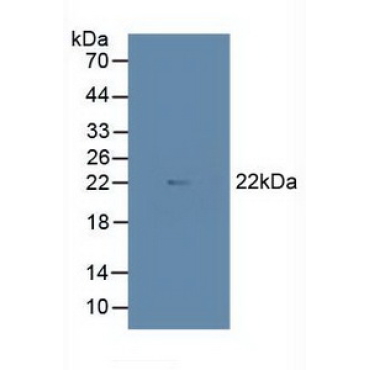 MYC Associated Factor X (MAX) Human Polyclonal Antibody