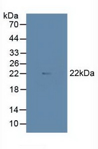 MYC Associated Factor X (MAX) Human Polyclonal Antibody