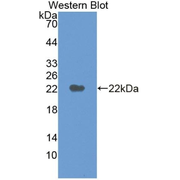 Mannose-6-Phosphate Receptor (M6PR) Human Polyclonal Antibody